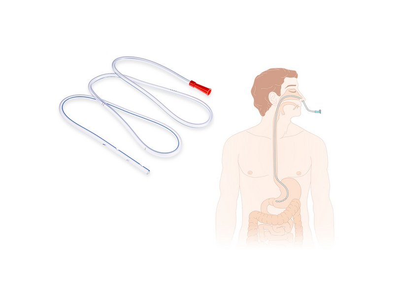 Зонд шлунковий «MEDICARE», розмір Fr 18